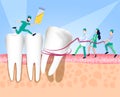 The doctor removes the diseased wisdom tooth. Enamel damage, tooth infection, bacteria. Dentistry, treatment of toothache. Vector